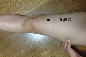 血海穴 血海穴