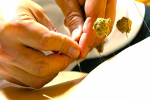 灸頭鍼 灸頭鍼