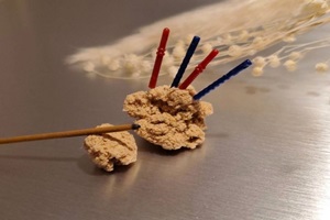 鍼灸 鍼灸