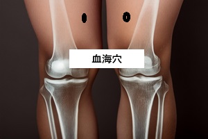 血海穴 血海穴